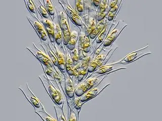 Złotowiciowce czyli złote algi pod mikroskopem