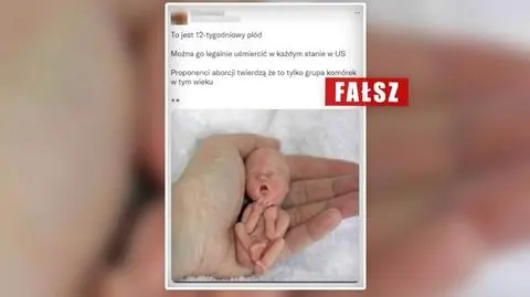 Zdjęcie płodu w 12. tygodniu ciąży? Nie, to powracający antyaborcyjny wiral