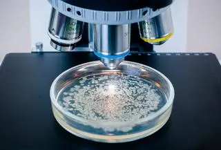 Legionella