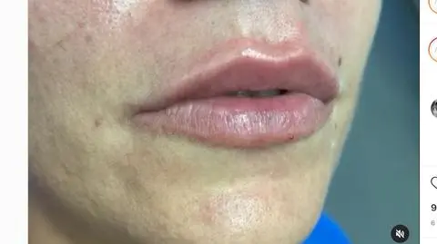 "Odradzam efekt sztucznej twarzy"