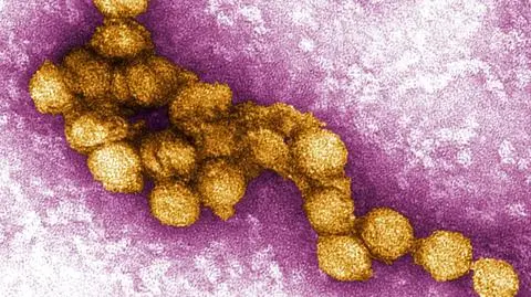 Wirus Zachodniego Nilu