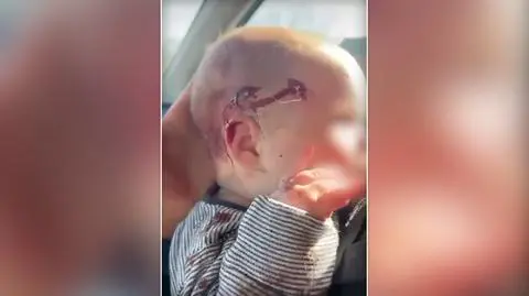 Wracali od lekarza. Ranna dwumiesięczna dziewczynka, jej matka walczy o życie