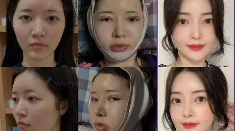 Co czwarta jeszcze przed trzydziestką miała operację plastyczną. Kim są Gangnam girls?