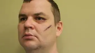 Obrażenia Dmytro Bułatowa