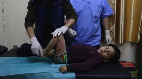 Chcą leczyć dzieci ranne podczas izraelskich bombardowań. Decyzja prezydenta