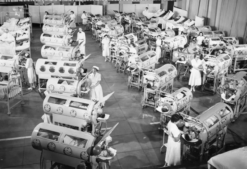 Dzieci w żelaznych płucach podczas epidemii polio w USA w latach pięćdziesiątych; Ranchos Los Amigos Respiratory Center