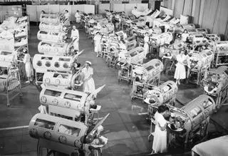 Dzieci w żelaznych płucach podczas epidemii polio w USA w latach pięćdziesiątych; Ranchos Los Amigos Respiratory Center