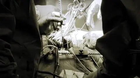 Reportaż "Człowiek bez serca"