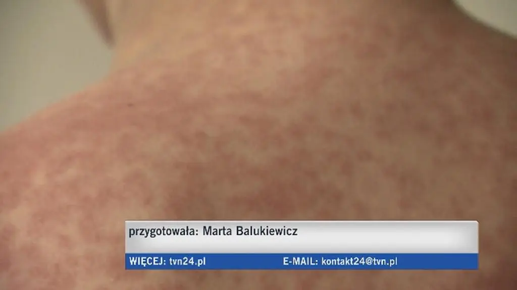Rodzice nie chcą szczepić dzieci
