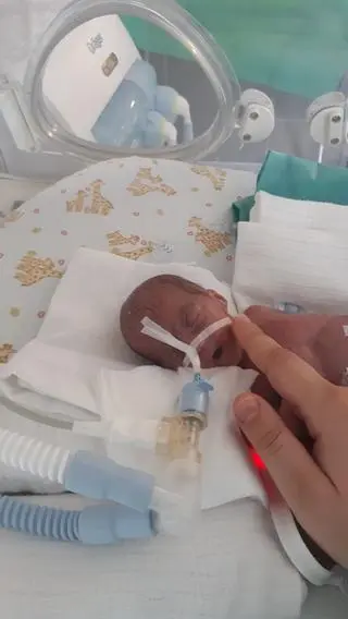 Mała Lilianka w inkubatorze