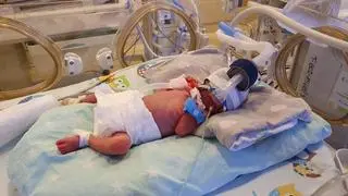 Ważą po około 700 gramów, najbliższe tygodnie spędzą w inkubatorach.