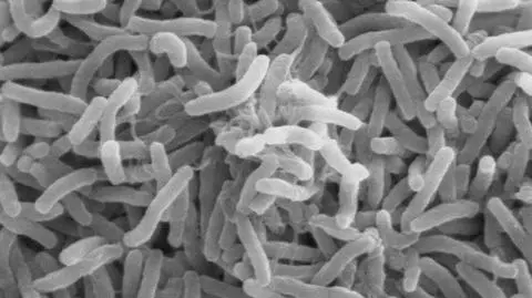 Cholera wzięła Papuę Nową Gwineę