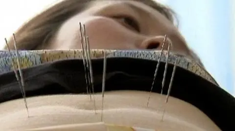 Igłami walczą z nadwagą