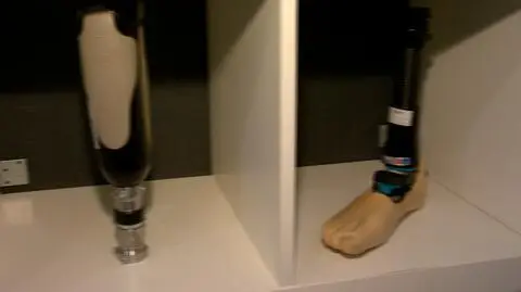 Bezdomny z odmrożonymi stopami będzie chodził