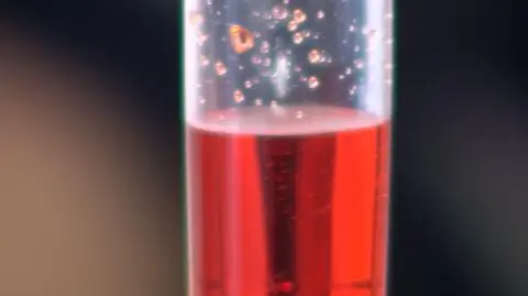 To może być przełom w myśleniu o ubocznych skutkach chemioterapii