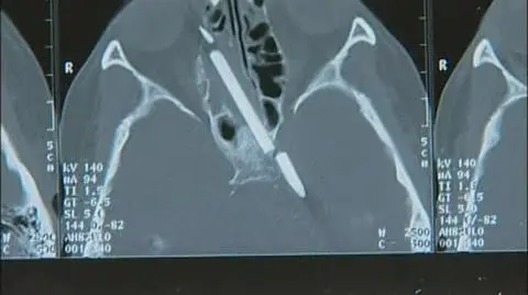 Pół wieku z....ołówkiem w mózgu