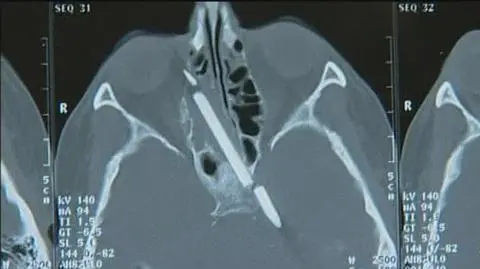 Pół wieku z... ołówkiem w mózgu