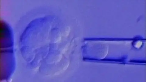 In vitro w Polsce taniej 
 i lepiej