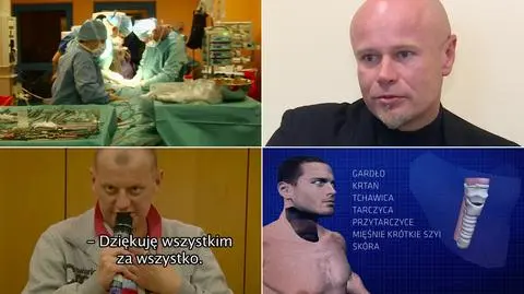 Zespół prof. Adama Maciejewskiego z sukcesem przeprowadził przeszczep narządów szyi