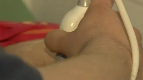 Statystyki w sprawie aborcji