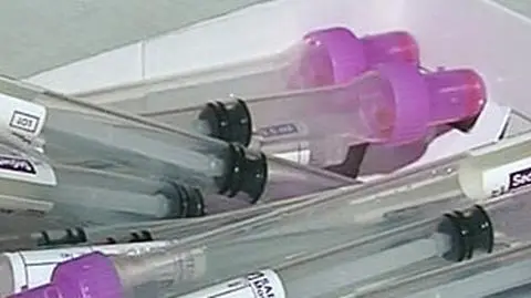 Zamiast w 3 dni, w 3 godziny dowiedzą się, czy mają A/H1N1
