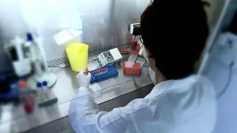 There have been 44 cases of measles in Masovian province alone. 87 in the whole country