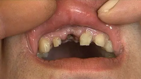 Stomatolog miał w organizmie blisko 3 promile alkoholu