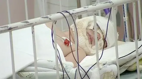 Będzie kurator dla poparzonych dzieci?