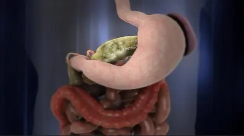 Pierwszy taki przeszczep