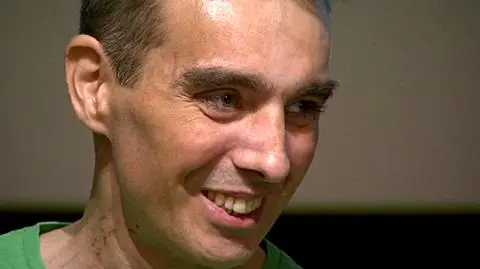 Oto człowiek bez serca. Żyje tak od 5 miesięcy
