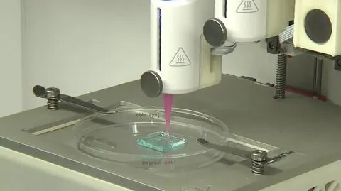 Prototyp bionicznej trzustki stworzyli naukowcy z Warszawy