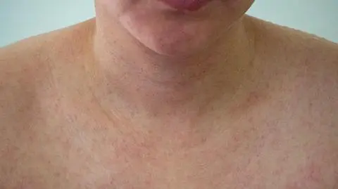 Niebezpieczna odra wraca do Polski. "Polska i świat" TVN24 z 6 maja