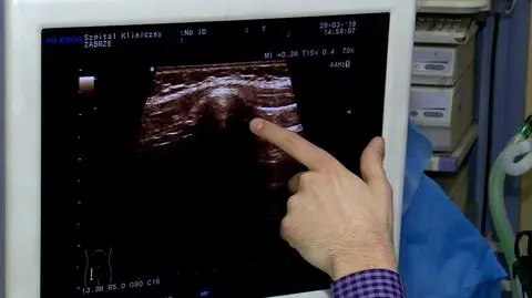 Polscy naukowcy: przepona odpowiada również za utrzymanie równowagi