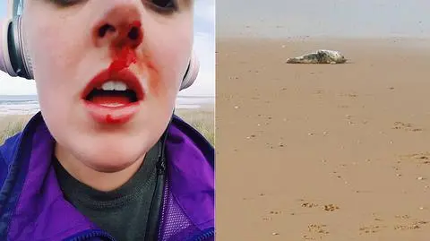 Sarah Tough. Chciała ratować fokę, dostała cios w nos