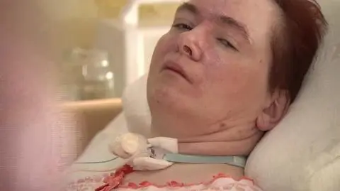 20.07.2014 | Zapadła w śpiączkę po użądleniu osy. Lekarze namawiają: warto się odczulić!
