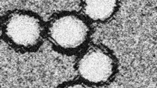 Wirus pod mikroskopem elektronowym