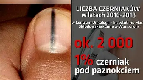 Lekarze ostrzegają: manicure może być niebezpieczny