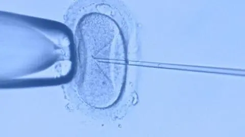 Szczecin. Sąd zakończył postępowanie ws. pomyłki in vitro