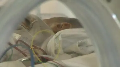 Sześciodniowemu noworodkowi przeszczepiono serce