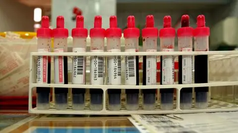 Z kolonii do szpitala przez zatrucie pokarmowe. Sanepid zamknie stołówkę?