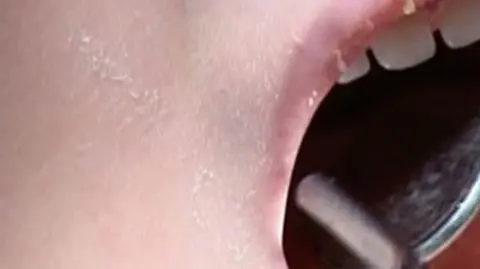 Mleczne zęby. Dlaczego warto zachować mleczaki i nie wyrzucać ich