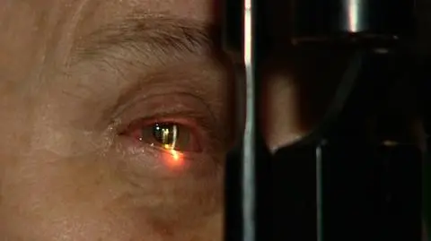 Szansa dla chorych na jaskrę