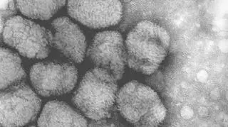 Wirus ospy prawdziwej wywołał liczne epidemie na świecie i może być stosowany jako broń biologiczna