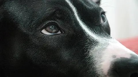 Kobieta pogryzła pitbulla