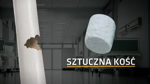 Naukowcy z Uniwersytetu Medycznego w Lublinie stworzyli sztuczną kość