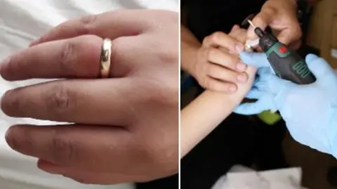 Przed porodem miała cięcie... obrączki. "Mogła stracić palec"