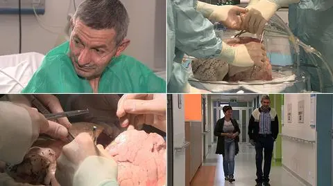 Pierwszy w Polsce przeszczep "słabych" płuc