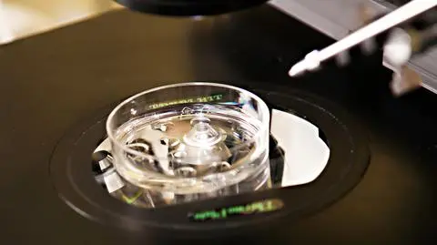 Radni Chojnic zapłaca za in vitro