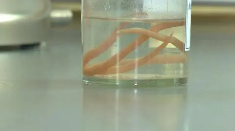 Sanepid chce zbadać dzieci pod kątem pasożytów