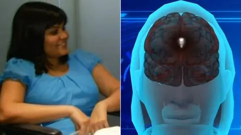 "Zła siostra bliźniaczka" w mózgu. "Torturowała mnie przez 26 lat"